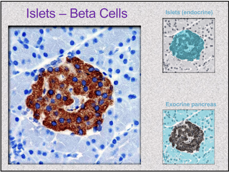 <p>INSULIN</p><ul><li><p>secreted during/ after meal when glucose and amino acid blood levels are rising</p></li><li><p>stimulates cells to absorb these nutrient and store or metabolize them; lowers blood glucose levels</p></li><li><p>promotes synthesis of glycogen, fat, and protein</p></li><li><p>suppresses use of already-stored fuels</p></li><li><p>insufficiency/ inaction= diabetes mellitus</p></li></ul><p></p>