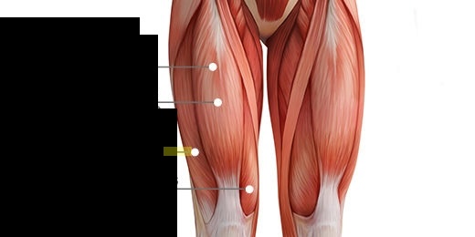 <p>What muscle is this?*</p>