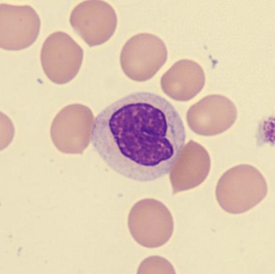 <p>What is this neutrophil showing?</p>