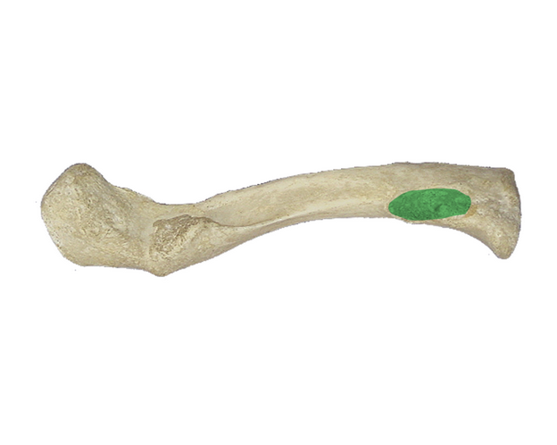 <p>What is the green portion called?</p>