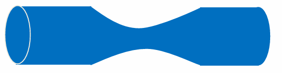 <ul><li><p>Airway narrowing and vibration which can be caused by:</p><ul><li><p>Thickened wall</p></li><li><p>Intraluminal obstruction (mucus/foreign body)</p></li><li><p>Bronchospasm</p></li><li><p>Extra luminal compression</p></li></ul></li></ul><p></p>