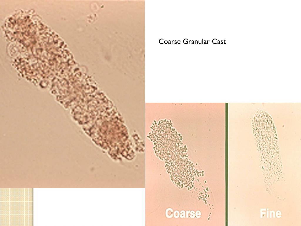 <ul><li><p>breakdown of cellular casts</p></li><li><p>any number is abnormal </p></li></ul><p></p>