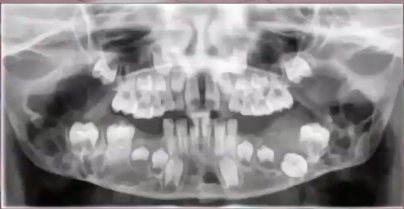 <p>diagnosis?</p>