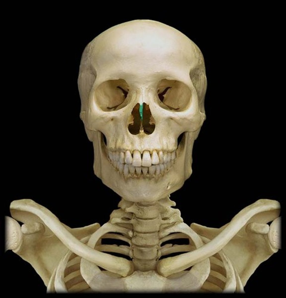 <p>superior portion of the bony nasal septum</p>