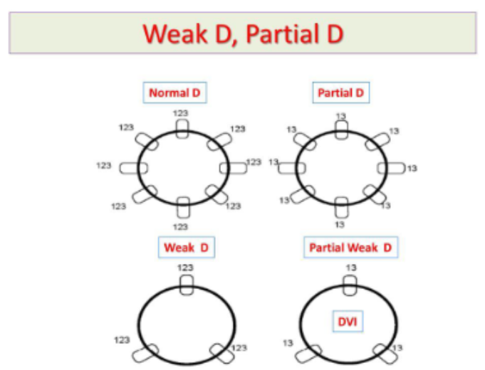 <p>D antigen is not complete, missing or altered epitopes, can form anti-D against the missing epitope(s)</p>