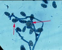 <p>The oval or curved multi-celled, dark-staining macroconidia divided by transverse septa seen in this image is characteristic of:</p>