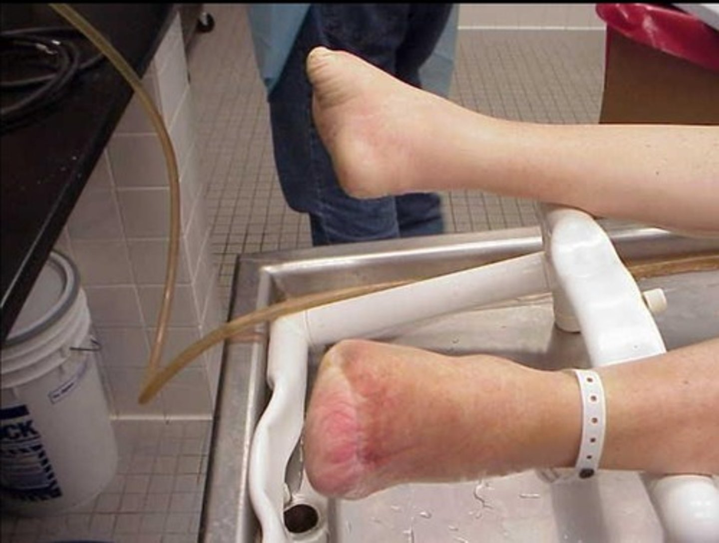 <p>a drain tube to create intermitten drainage</p>