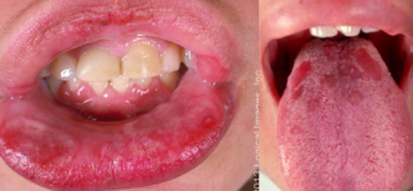 <p>Bacterial ID:</p>
