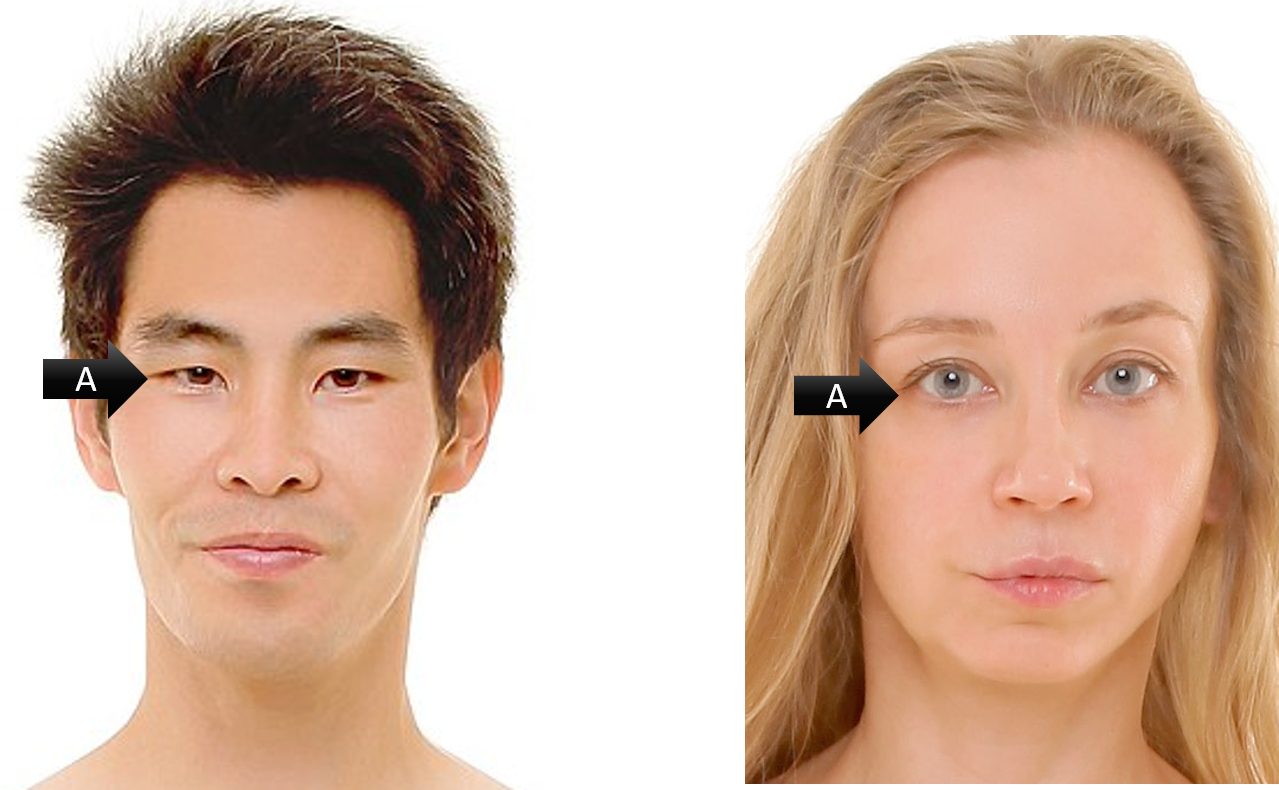 <p><span><span>Identify the gross anatomical region labeled A on both models</span></span></p>