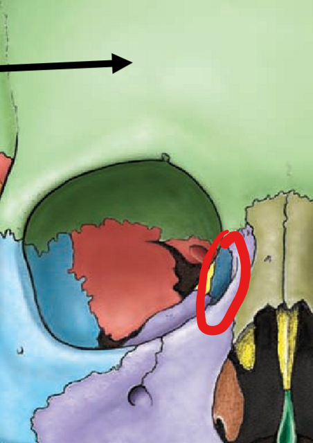 term image