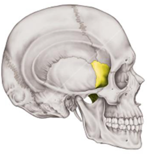 term image