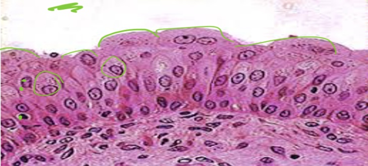 <p>Resembles both stratified squamous and stratified cuboidal</p><p>Stretches readily permits stored urine to distend urinary organ </p><p>Found in the bladder </p>