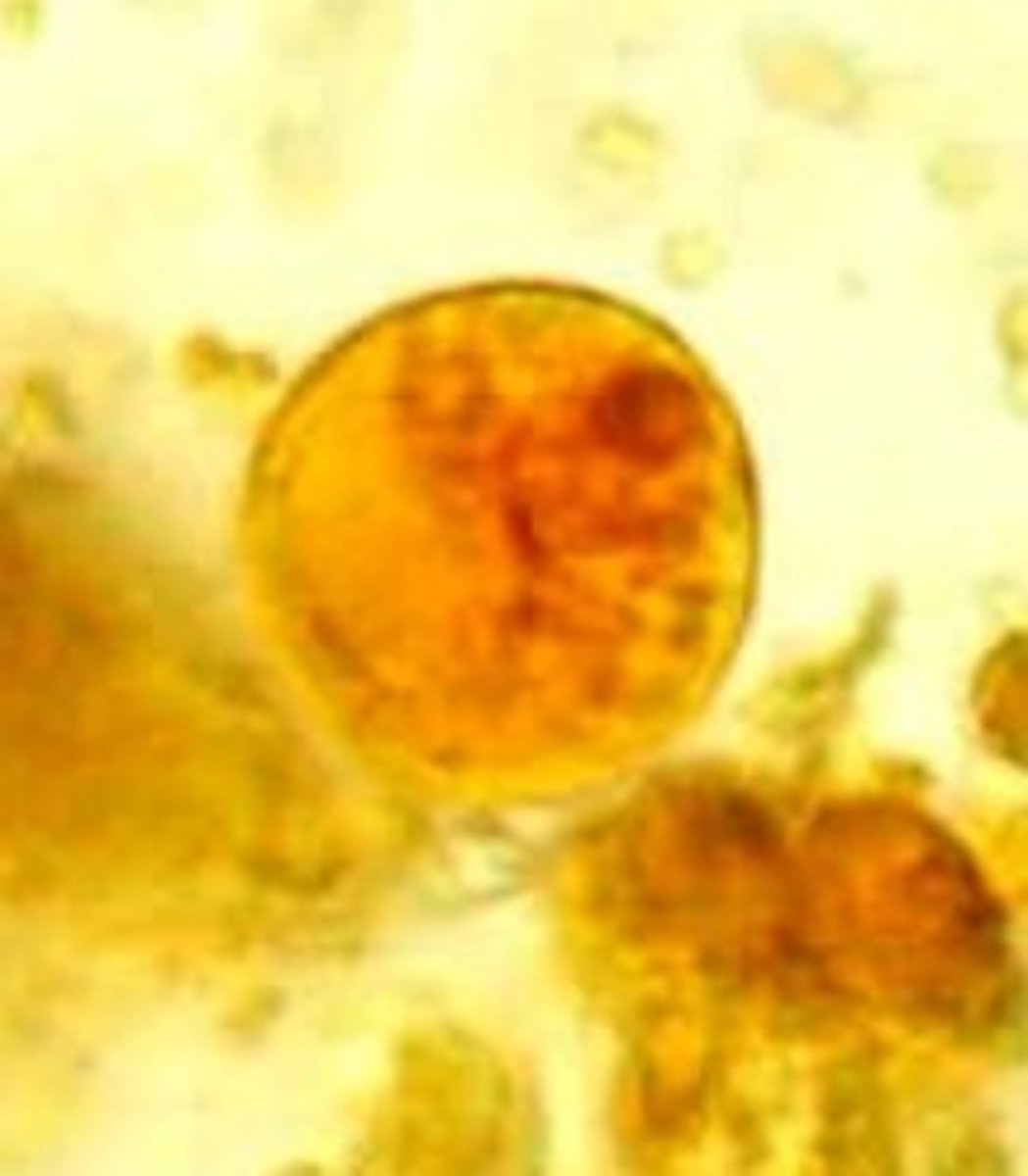 <p>Identify the parasite</p>