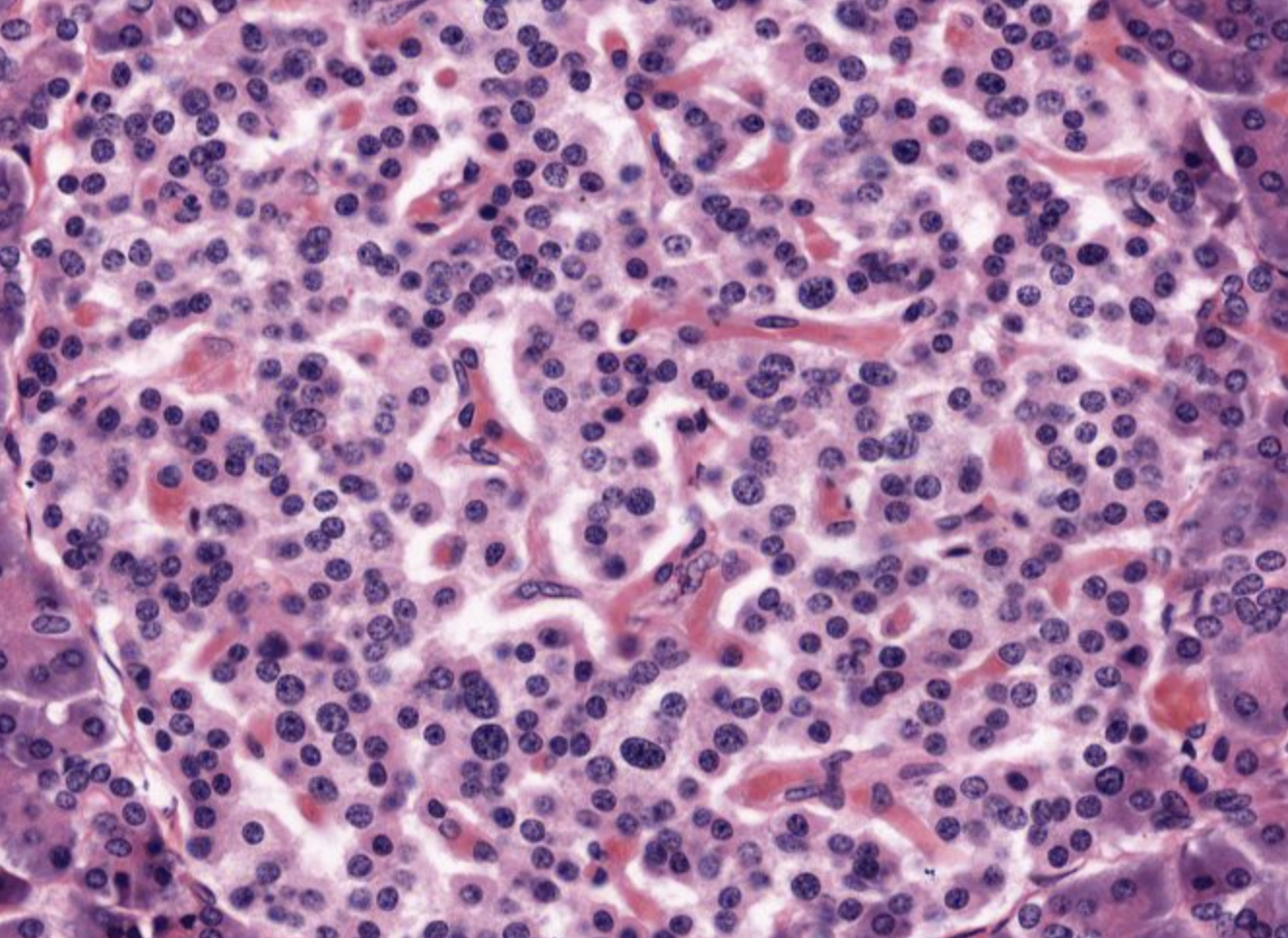 <p>Islet of Langerhans in Pancreas</p>
