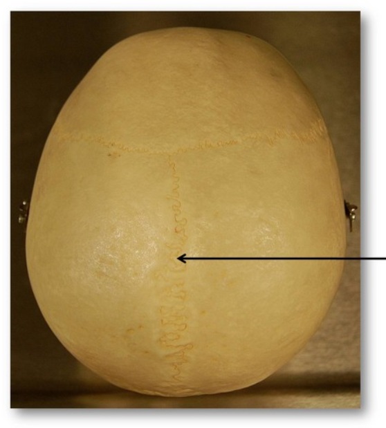 <p>Name this suture.</p>