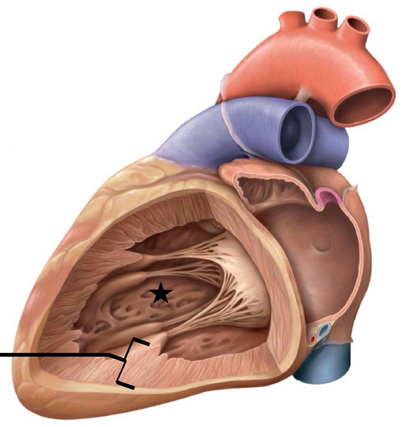 <p>What structure is identified by the black line?</p>