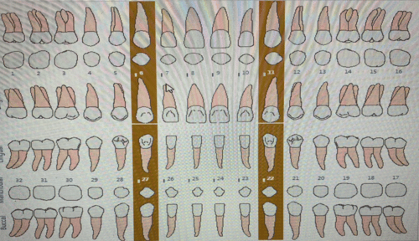 knowt flashcard image