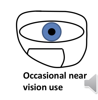 <p>Lower than the lower limbus of the eye</p>