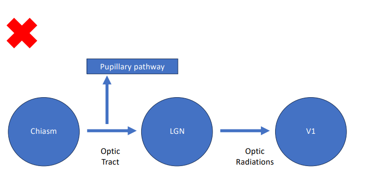 <p>The <strong>postchiasmal pathway </strong>(<strong>ipsilateral temporal </strong>fibers and<strong> contralateral nasal </strong>fibers) carries information from the <strong>contralateral visual field</strong> (e.g., right pathway from left field) thus postchiasmal lesions cause a <strong>homonymous field defect</strong>. </p><p><strong>Optic tract</strong>: relatively<strong> small in cross section </strong>so often a single lesion will <strong>damage the majority of fibers</strong> and causes a<strong> full homonymous field defect</strong>, if <strong>patrial may be incongruent. </strong>(affect one side more than other)</p><ul><li><p>Can cause<strong> optic nerve atrophy</strong> and/or<strong> pupillary defects</strong></p></li></ul><p>LGN lesions cause a <strong>defect in the contralateral field </strong></p><ul><li><p>Can cause <strong>optic atrophy</strong>, but <strong>no pupillary defects. </strong></p></li></ul><p><strong>Optic radiations</strong> running through the <strong>temporal lobe cause superior defects</strong>, while those running in the <strong>parietal lobe causes inferior defects.</strong> </p><ul><li><p><strong>Cannot cause optic atrophy or pupillary defects.</strong> </p></li></ul><p><strong>Occipital lobe</strong>: <strong>congruous hemianopsia</strong>, <strong>quadranopsia</strong>, possible <strong>macular sparing</strong></p><p></p>