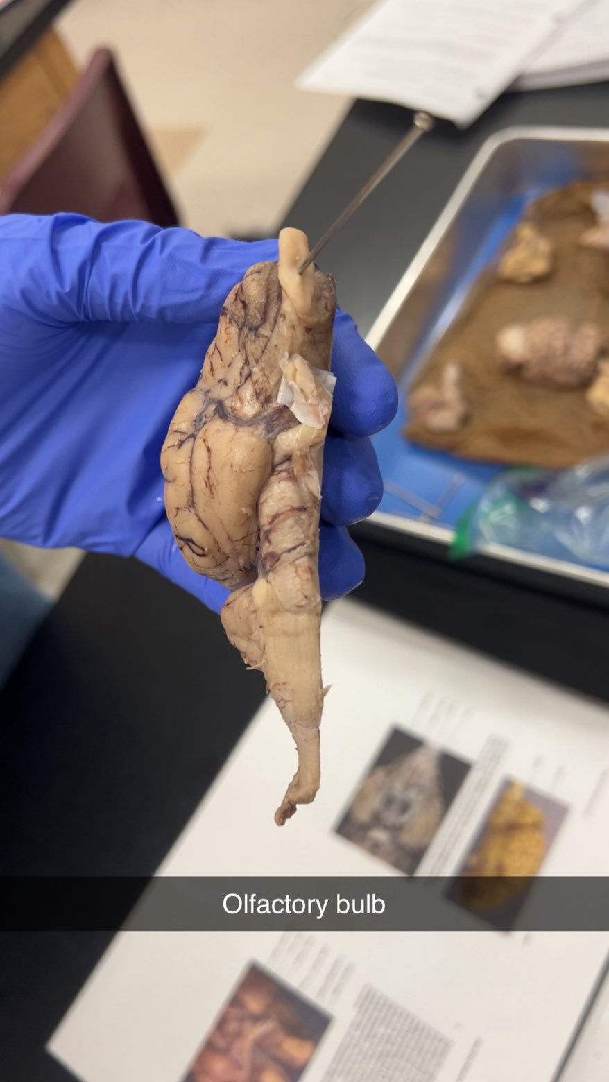<p>olfactory bulb</p>