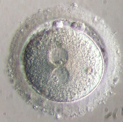 <p>Another term for a fertilised egg cell.</p>