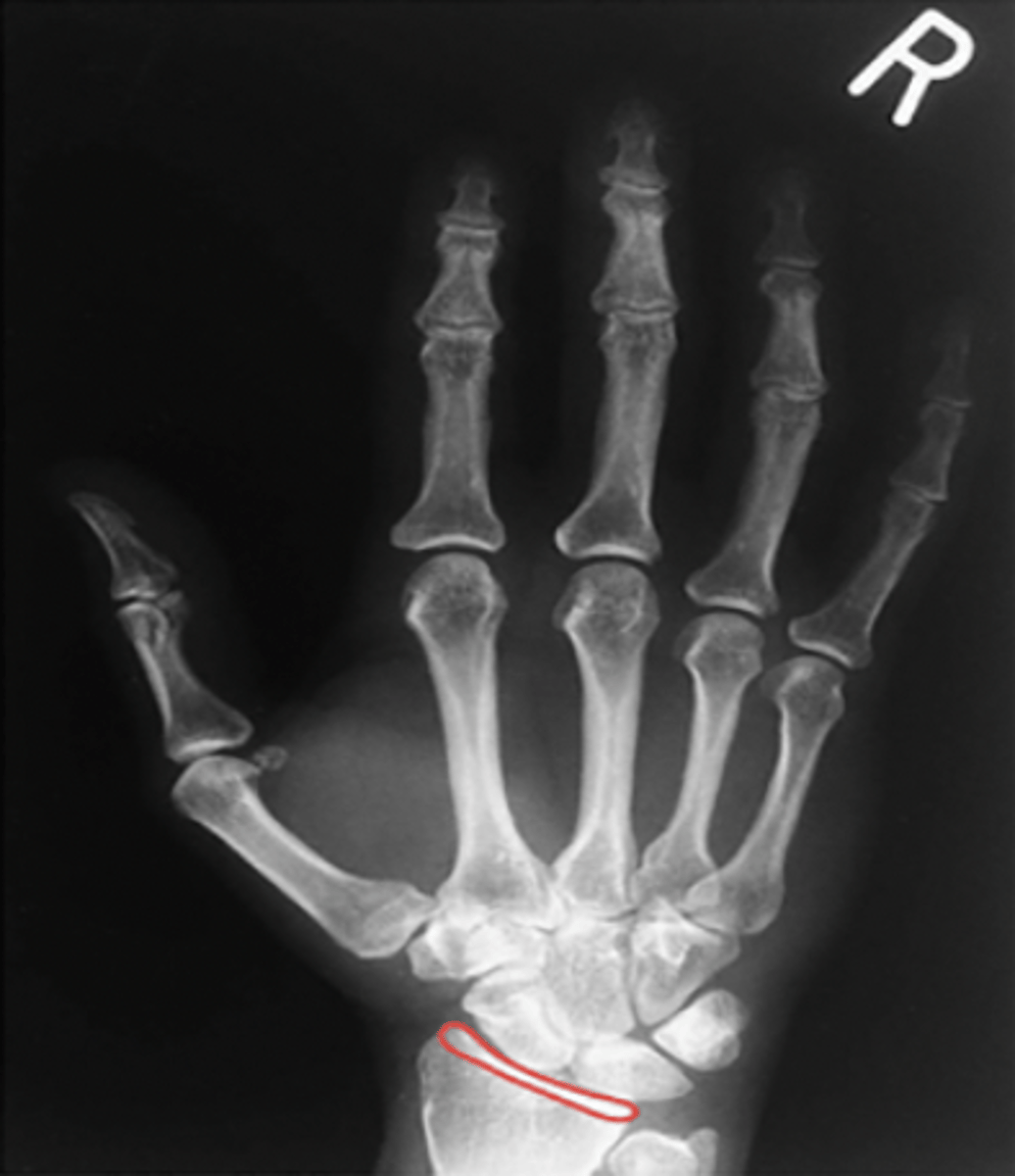<p>What structure is highlighted?</p>