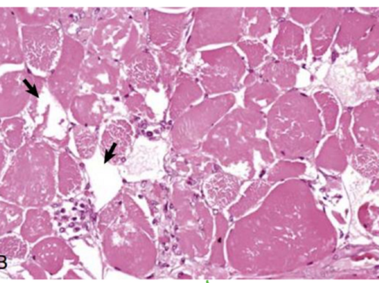 <p>What will cells will equine exertion rhabdomyolysis target?</p>