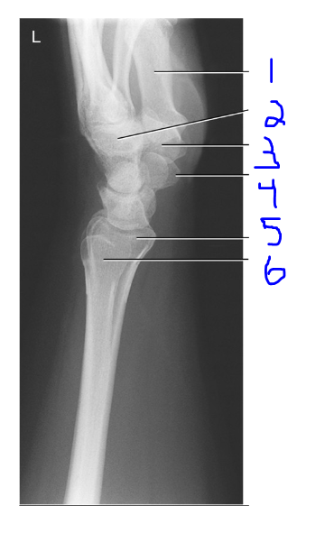 <p>Label</p>