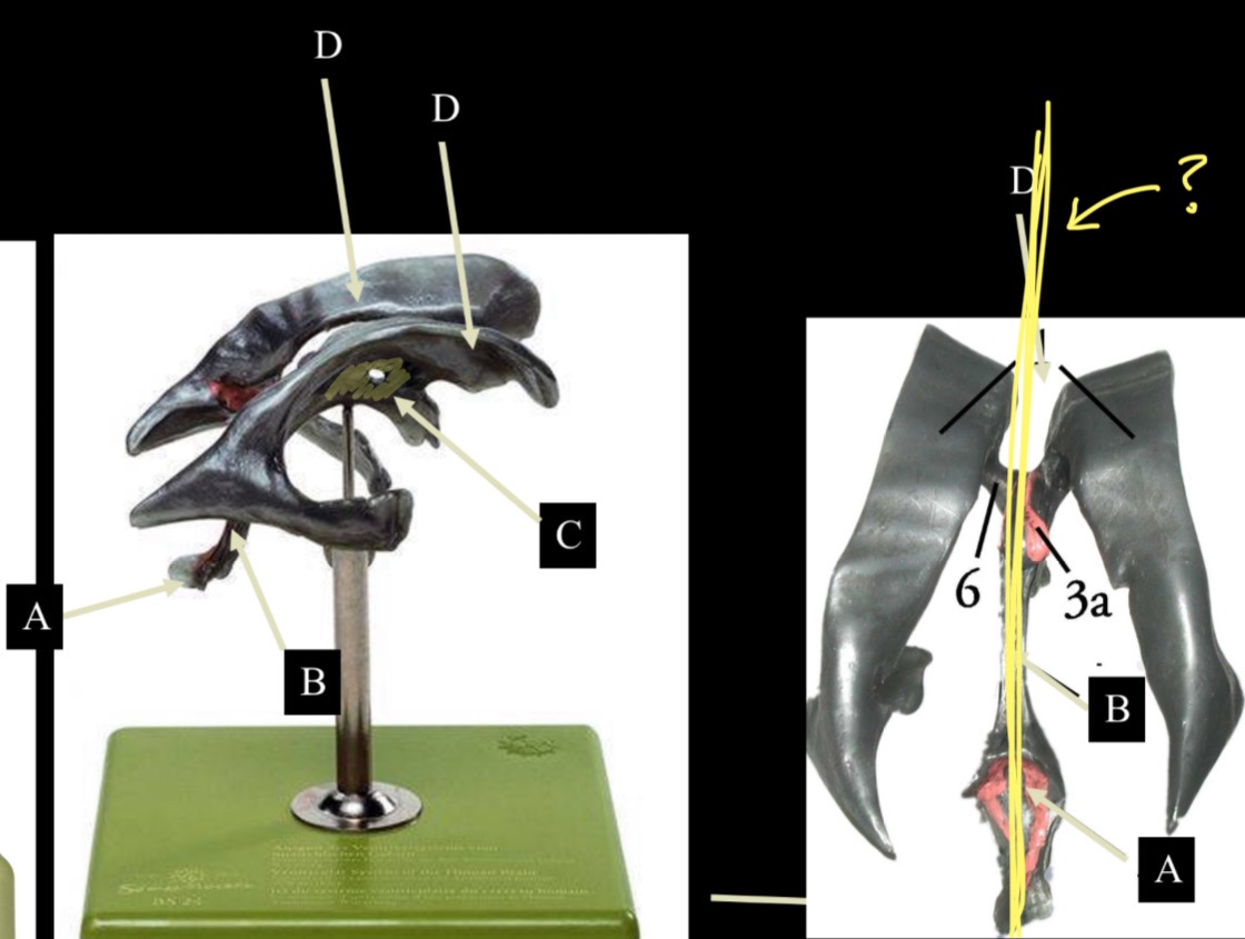 <p>Imagine thin membrane separating the 2 lateral ventricles</p>