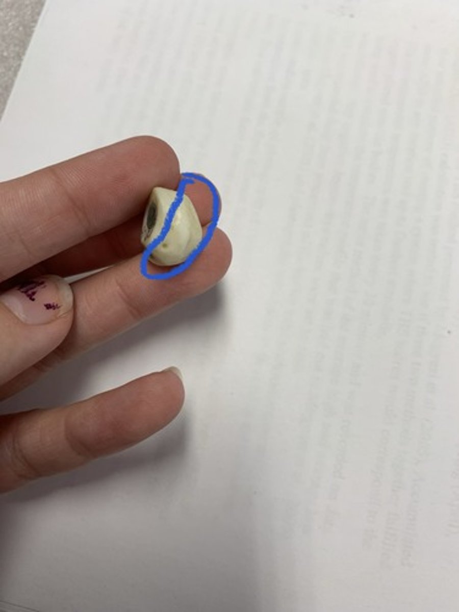 <p>The pisiform bone itself is a sesamoid bone that articulates with the triquetral bone.</p>