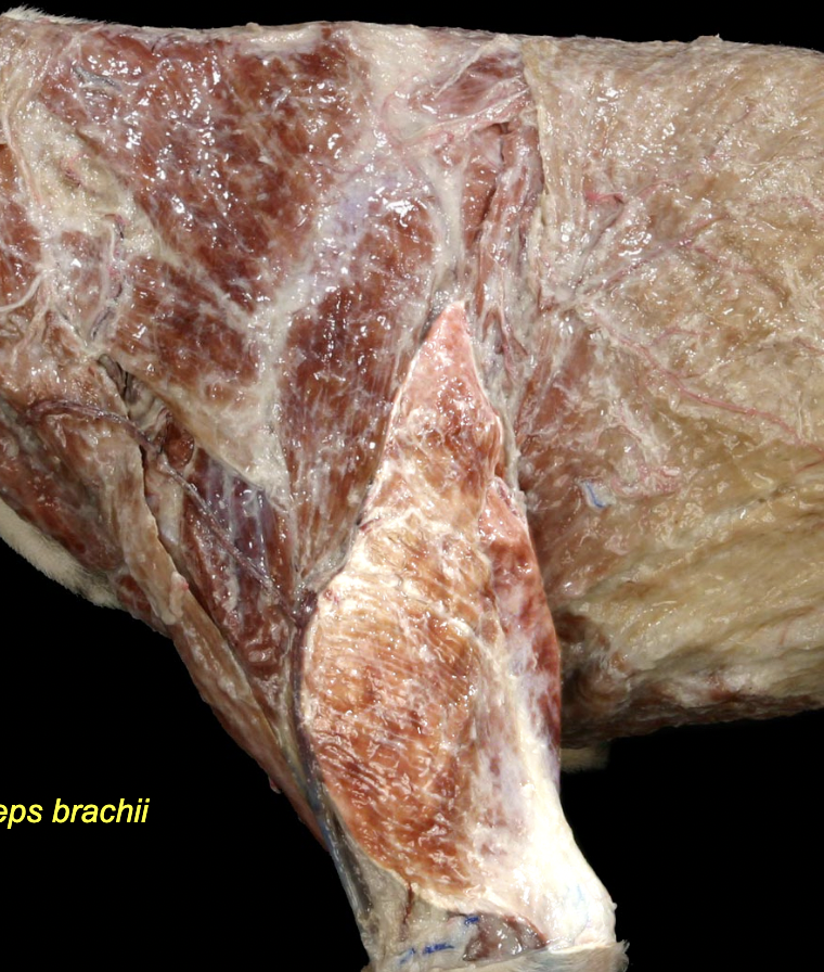 <p>Triceps brachii m.</p>