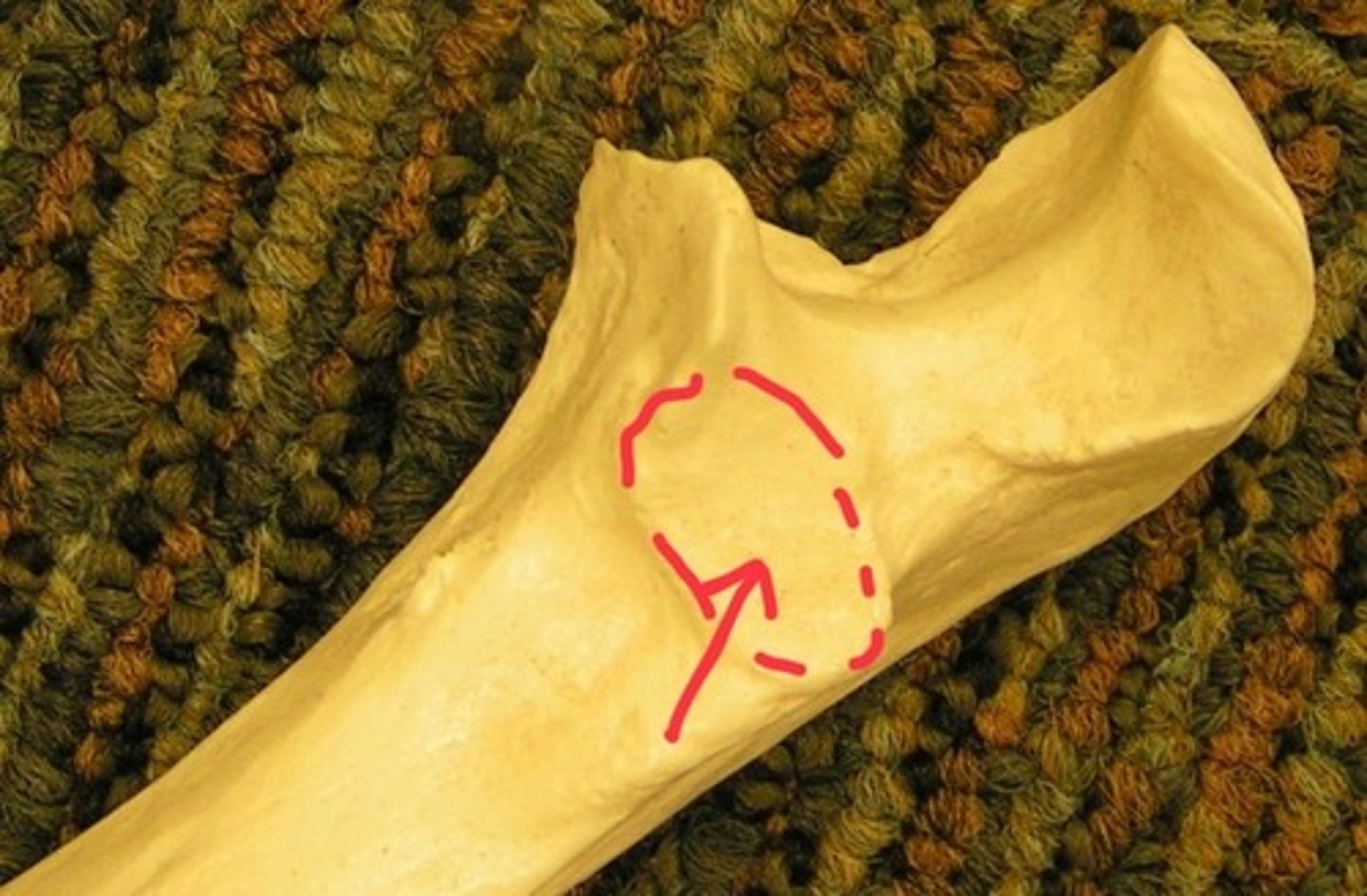 <p>lateral</p>