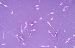 <p>What is wrong with these sperm?</p>