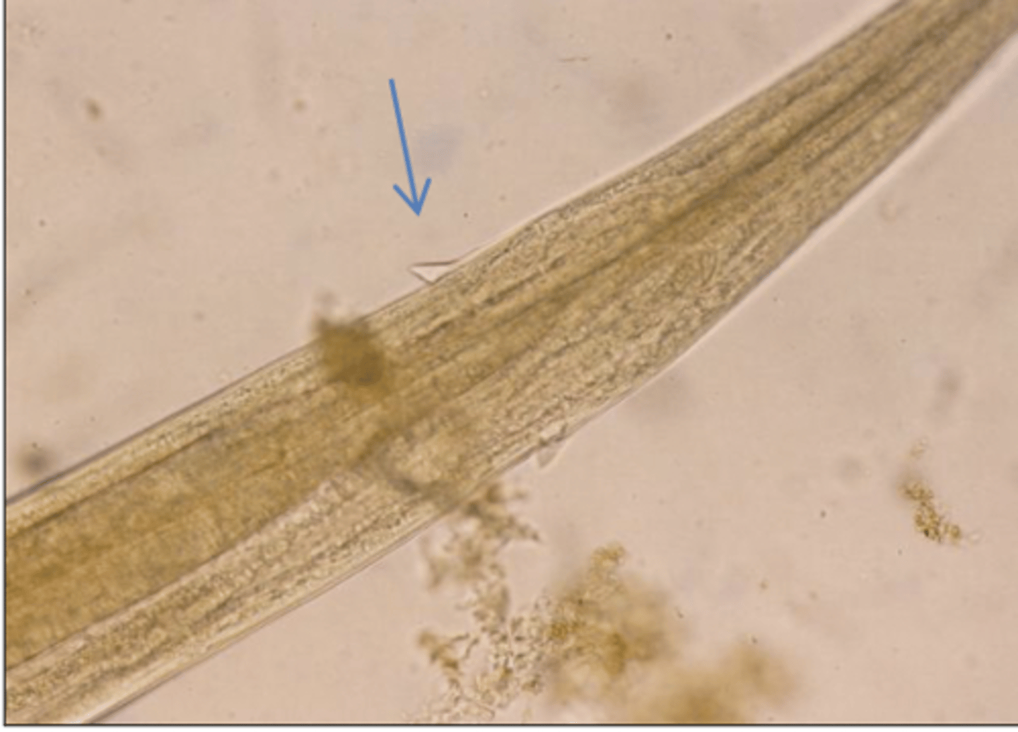 <p>What is this parasite? What characteristic/s did you use to identify it?</p>