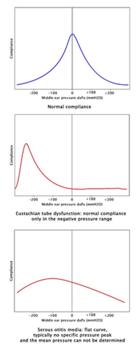 <p>Normal middle ear function: maximum compliance of ∼0 Pa</p><p>Eustachian tube dysfunction: displacement of normal compliance in the region of negative pressure</p><p>Secretory otitis media: flat tympanometry curve without an identifiable maximum</p>
