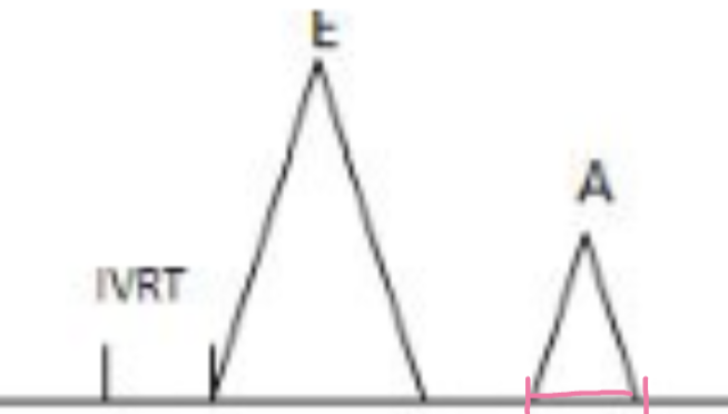 <p>Length of atria systole</p>