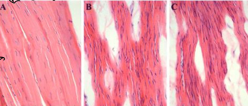<p>A, B and C show a longitudinal section of ligament, describe the differences between them</p>