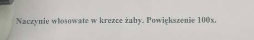 <p>cienki śródbłonek i mała średnica do wymiany substancji</p>