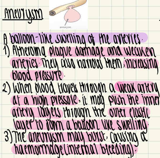 knowt flashcard image