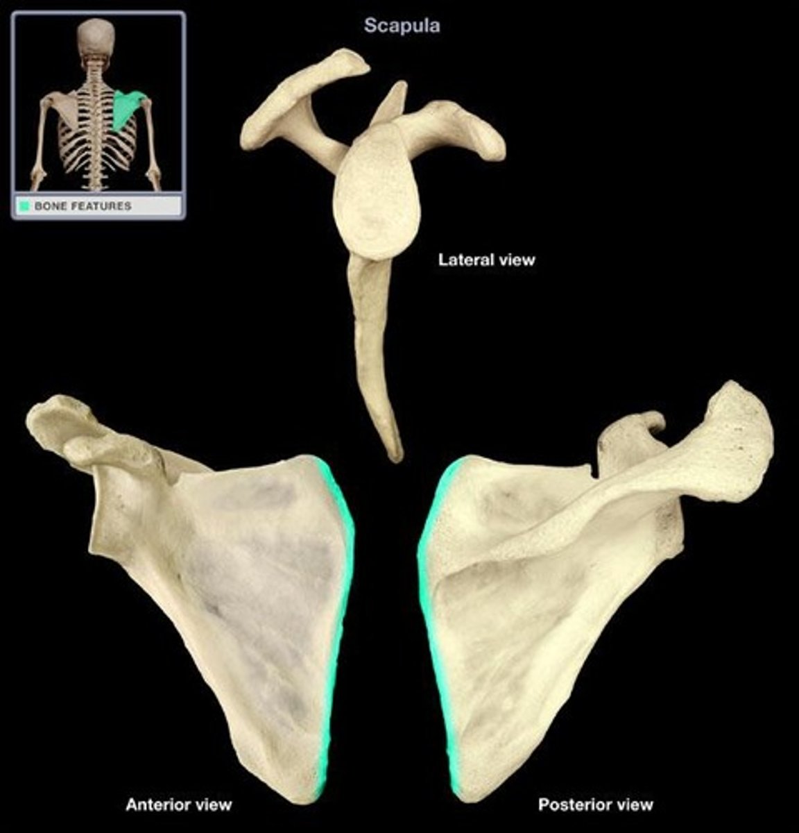 <p>Name the region of the bone.</p>