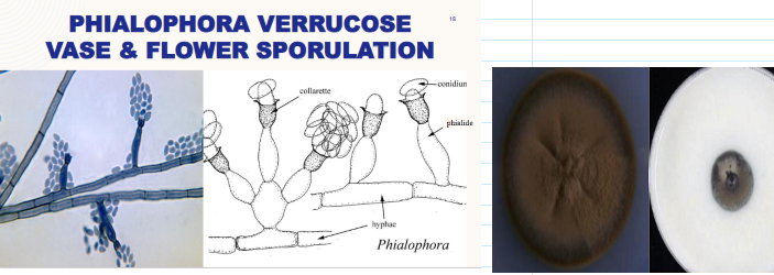 <ul><li><p><span><span>Slow growing (7-12 days)</span></span></p></li><li><p><span><span>Suede-like texture</span></span></p></li><li><p><span><span>Colonies become embedded in the agar</span></span></p></li><li><p><span><span>Reverse is black</span></span></p></li></ul><p></p>