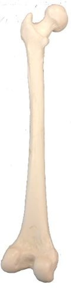 <p>Identify this bone.</p>