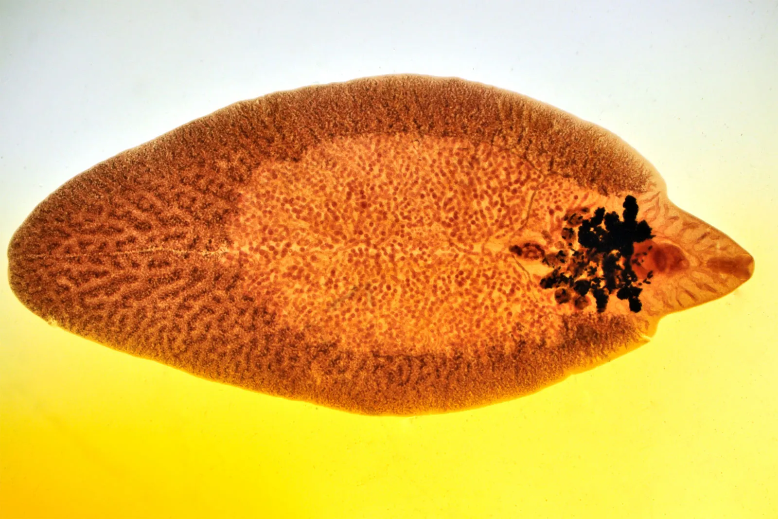 <p>in human or ruminant</p><p>liver fibrosis, blacks disease for cows/sheep</p><p>history of eating raw aquatic plants</p><p>worldwide</p>