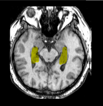 <p>What part of the brain is highlighted?</p>