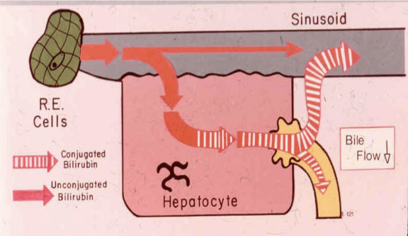 <p>Theres something wrong with the biliary tract, theres a block in the excreting of bili so conjugated bili gets shot back into the blood stream&nbsp;</p>