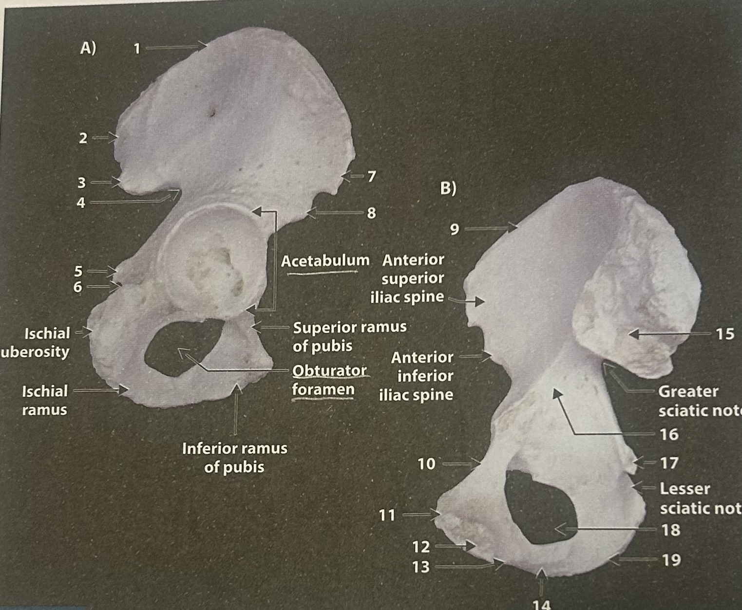<p>11</p>