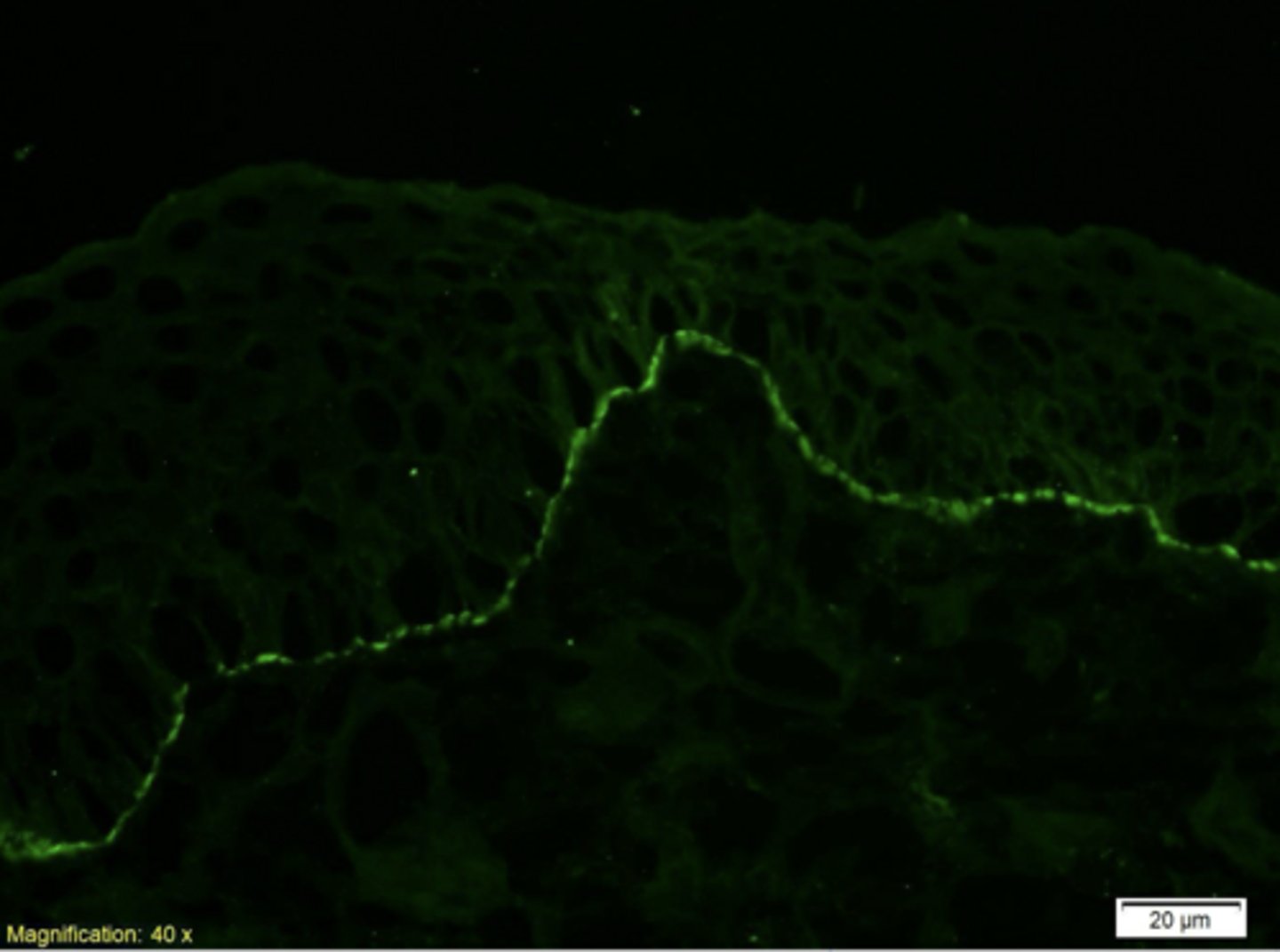 <p>What type of immunofluorescence?</p>