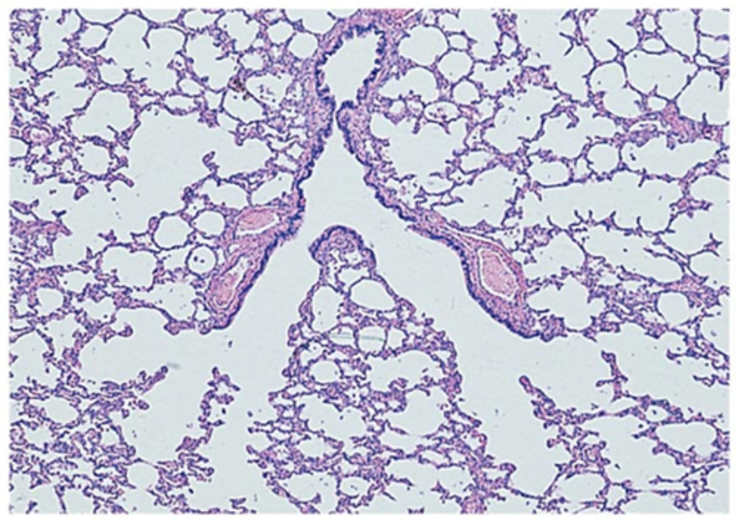 <p>simple squamous epithelium</p>