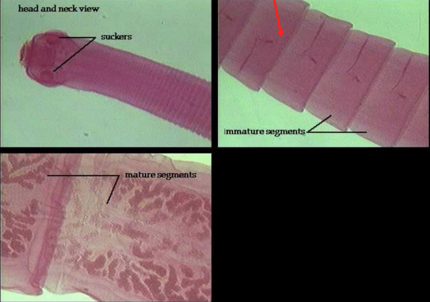 <p>phylum platyhelminthes: rhabditophora: class cestoda: proglottids</p>