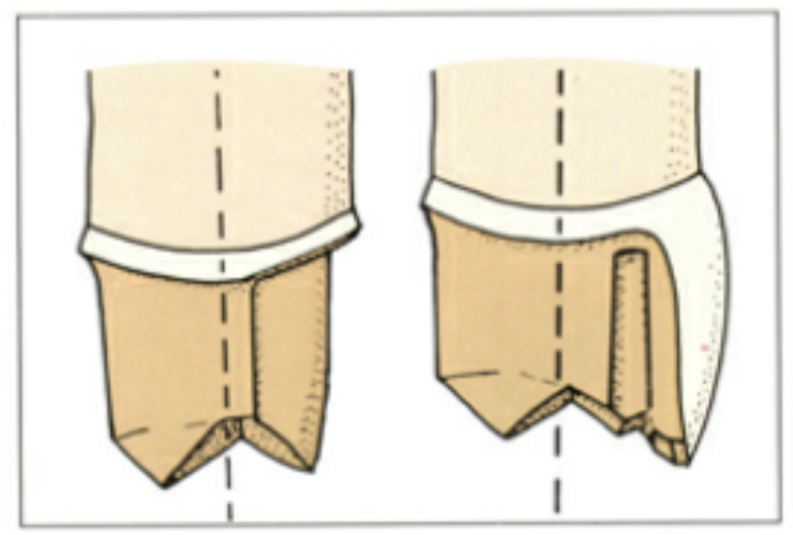 <p>parallel w the long axis of the tooth&nbsp;</p>